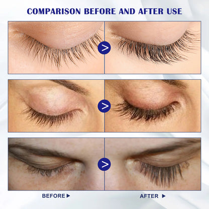 Supplement Nutrition Long & Thick Natural Curly Restore Damaged Lashes